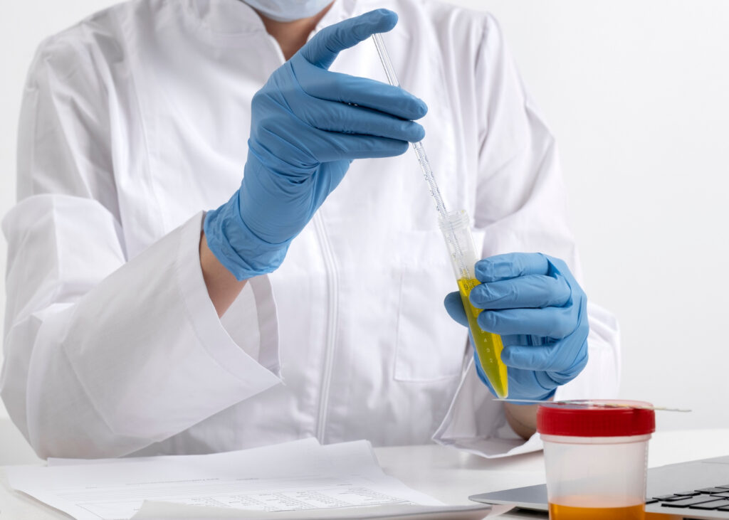 lab doctor performing medical exam urine 1024x731 1