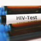 HIV Test 85x85